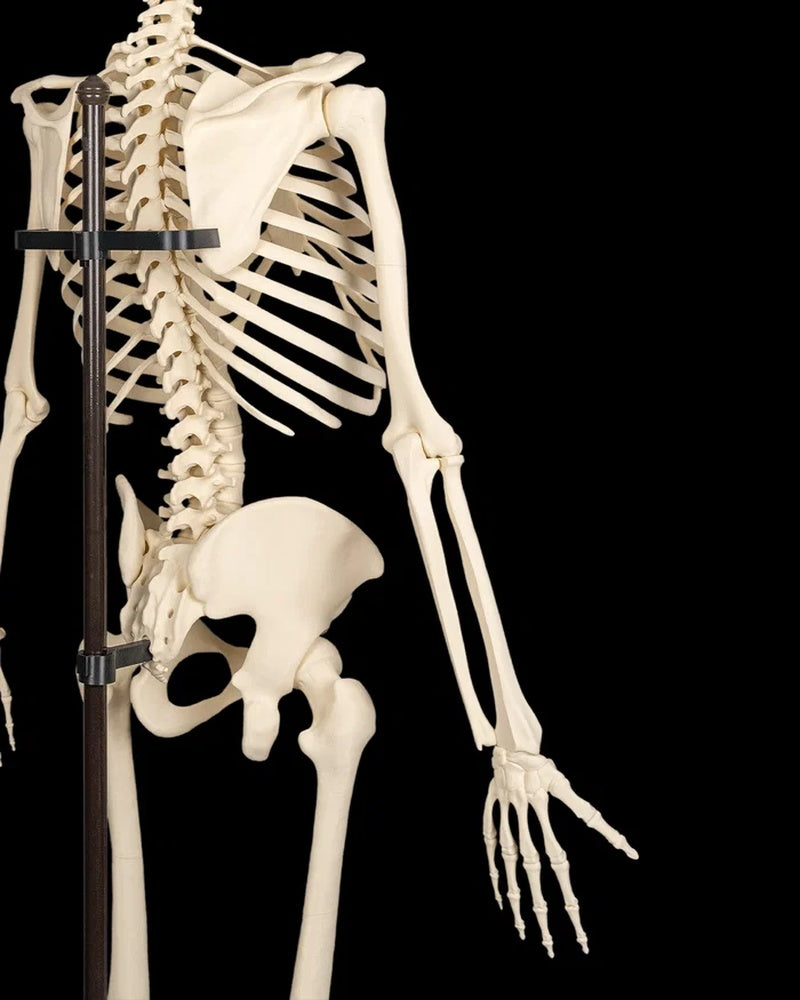 Partial human skeleton torso with an arm skeleton hanging beside a vertical support on a black background